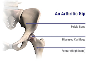 images/Diagnosis and Treatment of Hip Pain