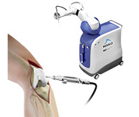 Mako Robotic-Arm Assisted Technology for Total Knee Replacement